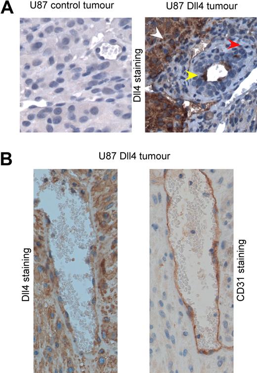 Figure 6. Dll4 can be transferred to mouse endothelial cells in vivo. (A) Immunohistochemical staining of hDll4 in control tumors derived from U87 cells or tumors derived from U87 overexpressing Dll4. hDll4 staining was not detectable in mouse tissue (red arrow); however, hDll4 staining was detectable in tumor tissue (white arrow) and in mouse vessels (yellow arrow). (B) Immunohistochemical staining of serial sections derived from a U87 Dll4 tumor to detect mouse CD31 and human Dll4. The cells surrounding the vessel were positive for CD31 and hDll4, which confirms that the mouse endothelial cells had acquired the hDll4 from the tumor cells. Images were taken with a Nikon Eclipse E800 microscope at 40× magnification.
