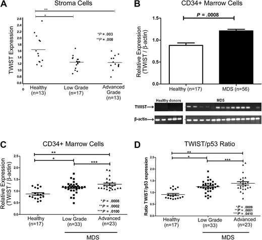 Figure 1. Expression of TWIST in patients with MDS and in healthy donors. (A) Stroma cells. mRNA levels were determined by quantitative real-time PCR. TWIST levels were lower in MDS than in healthy controls (see text). (B) CD34+ cells. Samples from 56 patients with MDS and from 17 healthy donors were analyzed. TWIST mRNA levels were significantly higher in patients with advanced MDS (P < .001). Shown are the means and SEM. The gel shows actual mRNA levels in 14 patients with MDS and 5 healthy controls. (C) TWIST levels in patients with MDS and healthy donors. Relative mRNA levels of TWIST were significantly higher in patients with low-grade (P < .001) and advanced MDS (P < .001) than in healthy donors. (D) Ratio of relative TWIST and p53 levels in patients with MDS and healthy donors. The ratio of TWIST to p53 mRNA differed significantly between cells from healthy donors and cells from patients with low-grade (P < .001) and advanced MDS (P < .001), respectively. Horizontal lines indicate median values.