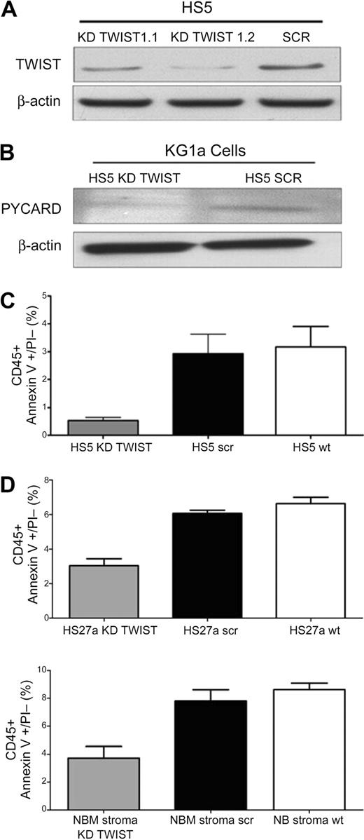 Figure 5. TWIST expression in HS5 stroma and effect on apoptosis in cocultured KG1a cells. (A) Expression of TWIST in HS5 cells transfected with scrambled siRNA (SCR) or TWIST-specific siRNA (KD TWIST 1.1 and KD TWIST 1.2). TWIST expression was determined by Western blot. β-Actin served as control. (B) Western blot of PYCARD protein in KG1a cells in contact cultures with HS5 cells, transfected with either a scrambled sequence (SCR) or with a TWIST-specific siRNA (KD TWIST), respectively. β-Actin served as loading control. PYCARD served as additional protein control for the stroma effect because we had shown previously up-regulation of PYACRD in KG1a cells after stroma contact.12 (C) Earl-stage apoptosis induced by TNFα (25 ng/mL) in KG1a cells that remained stroma-attached in control cultures containing unmodified HS5 cells (HS5 wt) and in cultures with HS5 cells transfected with either a scrambled siRNA sequence (HS5 scr) or siRNA specific for TWIST (HS5 KD TWIST). Apoptosis was determined by flow cytometry. Only CD45+ (KG1a) cells were considered. KG1a cells that had detached from stroma are not included. (D) Early-stage apoptosis induced by TNFα (25 ng/mL) in KG1a cells in contact with HS27a or normal bone marrow stroma (NBM), either unmodified (wt) or modified by transfection with a scrambled siRNA sequence (scr) or siRNA specific for TWIST (KD TWIST). Apoptosis was determined by flow cytometry. Only CD45+ (KG1a) cells were considered. KG1a cells that had detached from stroma are not included. Error bars indicate SEM.