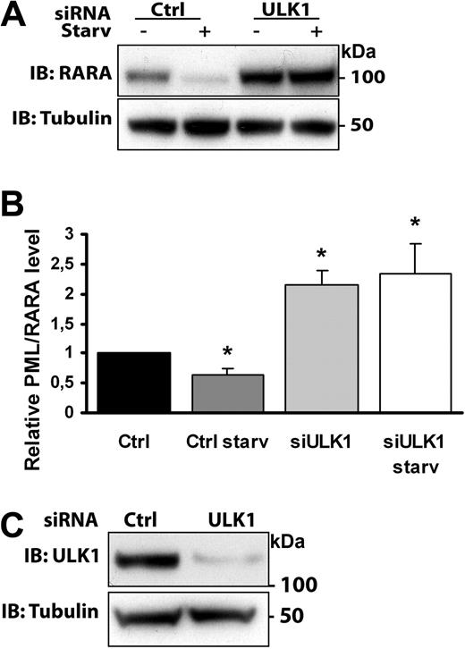 Figure 2. ULK1 depletion inhibits PML/RARA degradation. (A) HeLa cells transfected with control RNA or ULK1-targeted siRNA were retransfected with PML/RARA cDNA and treated or not with starvation media for 4 hours. Lysates were analyzed by Western blotting by use of the indicated antibodies. (B) Quantification of data from 3 independent experiments. Error bars represent SEM. *P < .05, Student t test. (C) Confirming depletion of ULK1: Lysates from control or ULK1-depleted HeLa cells were examined by Western blotting by the use of anti-ULK1 and anti-tubulin antibodies.