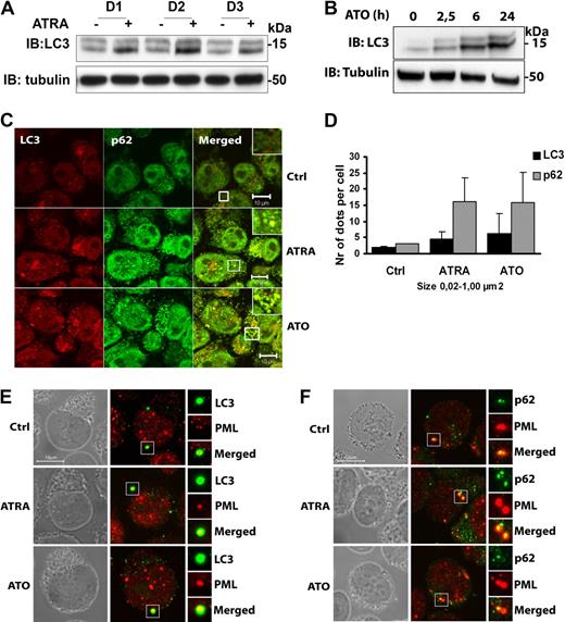 Figure 3. Autophagy is activated by ATRA and ATO in NB4 cells. (A) NB4 cells were treated with or without ATRA (1μM) for 1, 2, or 3 days (D1, D2, and D3, respectively), followed by IB analysis by the use of anti-LC3 and antitubulin antibodies. (B) Cell lysates from NB4 cells treated with or without ATO (1μM) for the indicated time were subjected to immunoblotting by the use of anti-LC3 and anti-tubulin antibodies. (C) NB4 cells with or without ATRA (1μM) or ATO (1μM) for 24 hours were stained with anti-LC3 (red) and anti-p62 (green) antibodies. Cells were examined by confocal microscopy. Scale bars, 10 μm. (D) The number and size (0.02-1.00 μm2) of p62- and LC3-positive structures were estimated by the use of the ImageJ quantification program from 2 separate experiments (total 150 cells). The graphs show average number of particles per cell ± SEM. (E-F) NB4 cells treated or not with ATRA or ATO were fluorescently labeled with antibodies against (E) PML (red) and LC3 (green) or (F) PML (red) and p62 (green). Cells were examined by confocal microscopy. Phase contrast images in grayscale are shown to visualize the nuclear boundary. Scale bars, 10 μm.