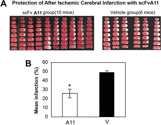 Figure 3. Coronal sections of mouse brains showing the infarcted areas in mice given scFv A11 or saline vehicle 2 hours before carotid obstruction. (A) Mouse brains were dissected into 8 coronal planes for each mouse at 1-mm intervals. Each section was stained red with triphenyltetrazolium chloride, fixed in 10% formalin, scanned into a commercial photo-image-editing program, and the data stored on a disk. (Left) A11-treated mice. (Right) Control mice injected with saline vehicle. The unstained area of infarct was computer calculated using an automated image analysis program (Image J 1.32, National Institutes of Health). (B) Quantitation of the protective effect of A11 given 2 hours before obstruction. *Statistically significant differences by Student t test (P < .003), A11 (n = 10) versus saline control (n = 6; SEM).