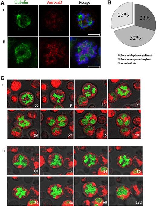 Figure 3. Inhibition of Aurora B by AZD1152-HQPA induces a chromosome segregation defect in mitotic and endomitotic MKs. (A) MKs were stained for tubulin (α and β, green), Aurora B (red), and DNA (blue). (Ai) In MK from untreated cultures, Aurora B accumulated in the midzone of multipolar endomitosis. (Aii) After AZD1152-HQPA treatment Aurora B localized in centromeres of segregating chromosomes. (B) The figure summarizes the percentage of MK mitosis abnormalities after incubation with AZD1152-HQPA: 52% cells were blocked in metaphase/anaphase, 23% in telophase/cytokinesis, 25% in normal mitosis; for multipolar endomitosis we did not find the telophase after incubation with AZD1152-HQPA. (C) Time-lapse images of H2B-GFP–expressing MKs were obtained by confocal video microscopy. Time relative to the first image is indicated in minutes on each image. (Ci) Endomitosis of control cell (8N, 4 poles) from metaphase to telophase. (Cii) Endomitosis of cell treated with AZD1152-HQPA (8N, 4 poles): metaphase, anaphase with slightly segregated chromosomes, and absence of telophase. Scale bars represent 10 μm.