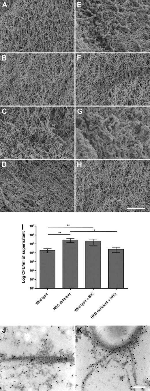 Figure 2. Clots formed in HRG-deficient or SIC-treated plasma fail to contain S pyogenes bacteria. Washed S pyogenes (E-H) or phosphate-buffered saline (A-D) was added to plasma, and clot formation was initiated by addition of Thrombomax reagent to wild-type (A,E), HRG-deficient (B,F), HRG-deficient plus purified HRG (C,G), or SIC-treated wild-type plasma (D,H). The fibrin network formed in the absence or presence of bacteria was analyzed using scanning electron microscopy. Scale bar represents 5 μm. Representative images of 4 independent experiments are shown. (I) The amount of bacteria present in the supernatant of clots A to H was quantified. Data are mean ± SEM; n = 4. **P = .001; *P = .02 (Mann-Whitney test). (J-K) The clot formed in wild-type plasma in the presence of S pyogenes was thin-sectioned, immunolabeled with anti-HRG, gold-labeled secondary antibodies (black dots), and subjected to transmission electron microscopy.