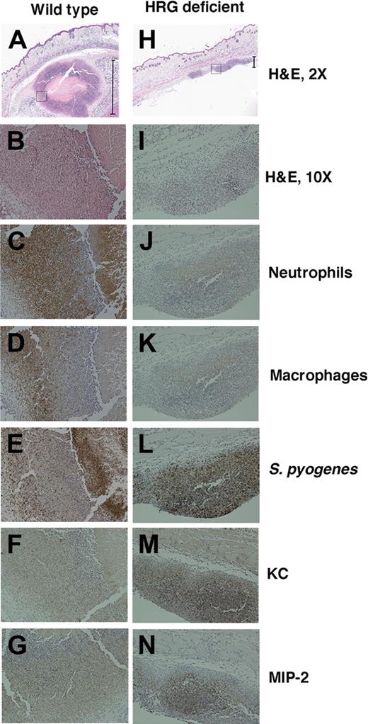Figure 5. HRG-deficient animals fail to contain S pyogenes at the local site of infection. Tissue samples from the local site of infection from wild-type animals (A-G) and HRG-deficient animals (H-N) were hemotoxylin and eosin-stained and immunostained for inflammatory markers. Representative images are shown at 2× magnification (A,H), and the black bars define the size of the inflammatory focus that was quantified as 1375 μm in the wild-type animal and 217 μm in the HRG-deficient animal. (A,H) The black box represents the section of the inflammatory focus that is shown at 10 × magnification in all subsequent images stained for hemotoxylin and eosin (B,I), neutrophils (C,J), macrophages (D,K), S pyogenes (E,L), and the chemokines KC (F,M) and MIP-2 (G,N).