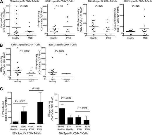 Figure 2. Expansion of EBV-specific effector T cells in PTLD. Polyclonal EBNA1-specific T cells and polyclonal BZLF1-specific T cells were generated from 19 healthy control and 14 EBV+ PTLD PBMCs using the 14-day peptide pool expansion protocol. On day 14, the cells were restimulated with the appropriate peptide pool and assayed for IFN-γ and CD107a/b production using flow cytometry. Results are as follows: (A) Number of IFN-γ or CD107a/b-producing CD8+ T cells expanded from 106 PBMCs. (B) Number of IFN-γ–producing CD4+ T cells (represented by the CD8− CD3+ population). (C) Comparison of EBNA1 and BZLF1-specific IFN-γ–producing CD8+ and CD4+ T cells