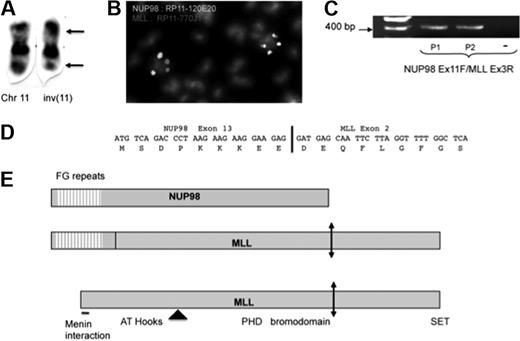 Figure 1. Analysis of the inv(11)(p15q23) in 2 patients with acute myeloid leukemia. (A) Partial karyotype of patient 1. Breakpoints are indicated by arrows. Chr indicates chromosome. (B) Fluorescence in situ hybridization on metaphase chromosomes of patient 1 shows split of the NUP98 (green) and MLL (red) loci. The bacterial artificial chromosomes used as probes are indicated on the Figure. (C) Reverse transcription–polymerase chain reaction with primers corresponding to NUP98 exon 11 and MLL exon 3 amplified an NUP98-MLL fusion transcript in samples with inv(11) but not in those from control. (D) Sequence analysis of amplified cDNA showed an in-frame fusion between exon 13 of NUP98 and exon 2 of MLL. (E) Schematic of the wild-type and fusion proteins. Some identified domains are indicated. The location of the majority of the MLL breakpoints is indicated by an arrowhead, and the taspase cleavage site is shown by a double-headed arrow.