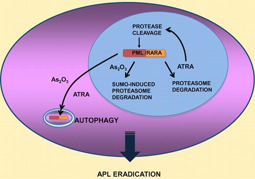 Schematic representation of the 4 pathways implicated in PML/RARA degredation by retinoic acid or arsenic trioxide (see text for details).