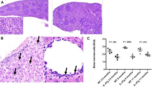 Figure 5. Mice transgenic for IL-4 expression have liver erythrophagocytosis, splenic histiocytosis, and extramedullary hematopoiesis. (A) Hematoxylin and eosin stains of B6 WT spleen (left) and spleen (×4) from IL-4 TG.UG mice (right) showing areas of normal white pulp (arrows). Histiocytosis and extramedullary hematopoiesis are only seen in the TG.UG spleen as shown in areas marked with yellow stars. (Insets) Original magnification ×100 (view of red pulp). Stars in wild-type mice indicate normal red pulp. (B) Hematoxylin and eosin stain (×40) of liver showing erythrophagocytosis (arrows). (Inset) Original magnification ×100 from a representative 11-month-old B6 IL-4 transgenic mouse. (C) Bone marrow cellularity from 1 long bone of IL-4 transgenic and age-matched wild-type B6 mice (4 from each group evaluated).