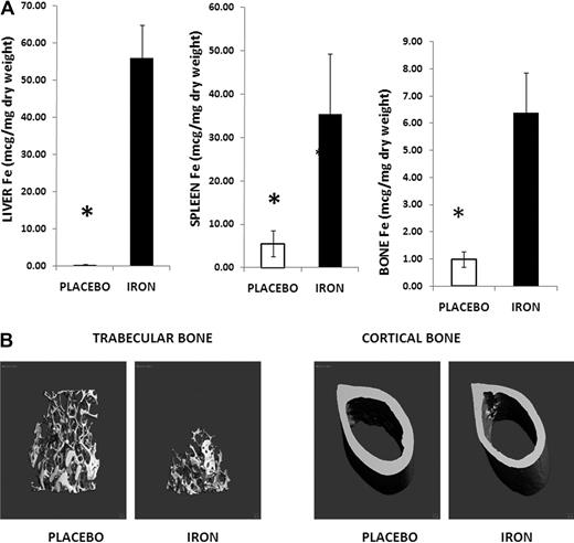 Figure 1. Iron-overloaded mice exhibit osteoporosis. (A) Liver, spleen, and femur iron contents increased in iron dextran-treated animals (▬) compared with controls (▭). Note the change in scale. Data are mean ± SD. *P < .01. (B) Micro-CT images of iron-overloaded animals and their placebo controls: femoral sections showing thinning of trabecular bone, with mid-diaphysis femur demonstrating thinning of the cortical bone and increased marrow area.
