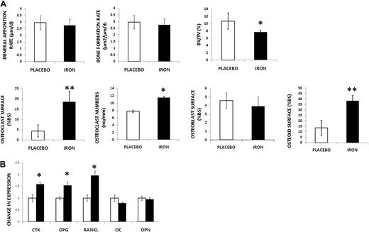 Figure 2. Iron-overloaded mice exhibit decreased bone mass, increased resorption, and increased deposition of osteoid. (A) First row: No changes in MAR and BFR by double-label technique in the iron-overloaded mice compared with placebo. Decreased BV/TV (von Kossa stain) with iron excess. Second row: Increased osteoclast surface (Goldner trichrome stain) and increased osteoclast numbers (no/mm) by TRAP in iron-treated mice. No changes were found in osteoblast numbers between placebo and iron-treated mice using stain for procollagen type I. Increased osteoid was present in the iron-treated animals. Data are mean ± SD. *P < .05. **P < .01. (B) Increased expression of genes associated with bone resorption (CTK, OPG, and RANKL) in iron-overloaded mice. No changes in expression of OC and OPN. Data are mean ± SD. *P < .01.