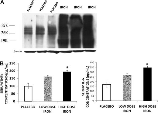 Figure 3. Iron overload induces inflammatory changes. (A) Western blot for protein carbonyl content from bone marrow of placebo and iron dextran-treated mice. An overlapping series of bands were present in the iron-overloaded animals, indicating increased carbonyl content in a number of bone marrow proteins consistent with increased ROS in the bone marrow of these mice. (B) Serum TNF-α and IL-6 concentrations in mice treated for 2 months with high-dose (▬) or low-dose iron dextran () and placebo (▭). Serum cytokines increase in a dose-dependent fashion. Data are mean ± SD. *P < .01.