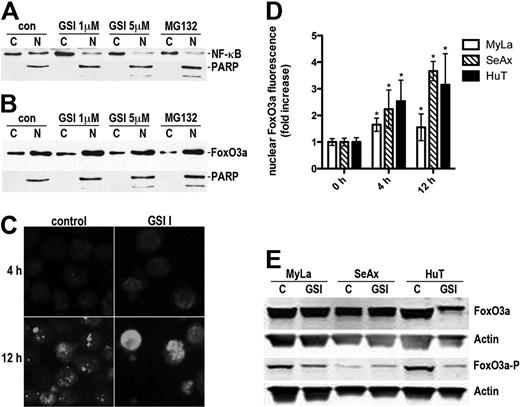 Figure 5. Inhibition of NF-κB signaling and nuclear translocation of FoxO3a by GSI I. (A) Western blot of cytoplasmic (C) and nuclear (N) extracts of MyLa cells treated with GSI I (0-5μM, 6 hours) showing a concentration-dependent decrease in the nuclear NF-κB content. The positive control was treated with the NF-κB inhibitor, MG132 (10μM). Immunoblotting with anti-PARP documented the purity of the cytoplasmic and nuclear extracts. (B) The cytoplasmic (C) and nuclear (N) fractions of MyLa cells were obtained as in Figure 4A, and the blots were probed with the FoxO3a-specific antibody. The blot shows a translocation of FoxO3a from the cytoplasm to the nucleus. PARP is a marker of fraction purity, as in Figure 4A. (C) MyLa cells were treated with 5μM GSI I or the vehicle for 4 hours or 12 hours, fixed and stained with the anti-FoxO3a antibody followed by the AlexaFluor568-conjugated secondary antibody. The cells were observed in confocal microscope (Olympus, FluoView Confocal System). Original scale of the images is 50 μm × 50 μm. (D) Nuclear FoxO3a fluorescence was quantified from the confocal microscopy images of CTCL lines treated with GSI I as in panel A (n = 10 cells per group). *P < .05 compared with the control (t test). Bars represent mean ± SD. (E) Phosphorylation of FoxO3a in CTCL cells treated with the vehicle or 5μM GSI I for 4 hours. The cellular content of the whole FoxO3a and FoxO3a phosphorylated at Ser318/321 was determined by Western blot. Compared with MyLa and HuT-78, SeAx had low basal levels of phosohorylated FoxO3a, and band intensity quantification exhibited no decrease in phosphorylation after treatment.