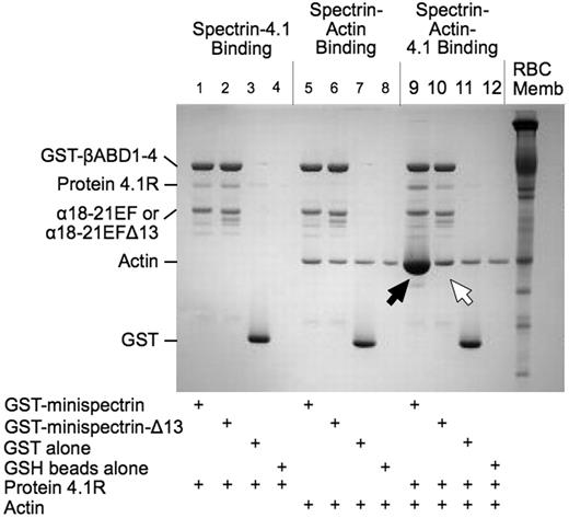 Figure 2. Interactions of normal and sph1J mutant minispectrins with actin and protein 4.1R assessed by a GST pulldown assay. Minispectrin-4.1R (lanes 1-4): 4.1R binds equally to both the normal and mutant minispectrins and does not bind to GST alone or to the GSH beads. Minispectrin-actin (lanes 5-8): The results show a slight interaction of the normal minispectrin with actin (more actin is bound in lane 5 than in lane 6). The mutant minispectrin does not interact (ie, the amount of actin bound is the same as the nonspecific binding observed in the controls). Minispectrin-actin-4.1R (lanes 9-12): A large amount of actin binds to the normal minispectrin (lane 9, black arrow), but only a small amount binds to the minispectrin lacking the C-terminal 13 amino acids of the α-spectrin EF domain (lane 10, white arrow).