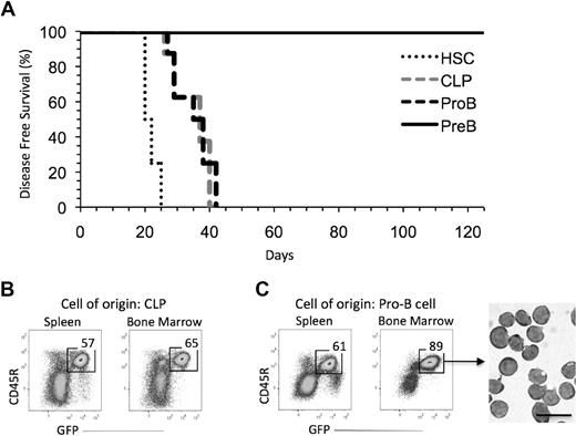 Figure 1. Immature B-cell progenitors can generate B-ALL. (A) All recipients of BCR-ABL/GFP–transduced HSCs (n = 8; 11 000 cells/mouse), CLPs (n = 8; 25 000 cells/mouse), and pro-B cells (n = 8; 65 000 cells/mouse) developed leukemia by day 42 posttransplantation. Recipients of BCR-ABL/GFP–transduced pre-B cells (n = 12; 100 000 cells/mouse) showed no sign of disease. Results pooled from 3 independent experiments in which 2 to 4 recipients were reconstituted with the indicated cell population in each experiment. (B-C) FACS profiles of leukemic cells in the spleen and bone marrow of recipients of BCR-ABL/GFP–transduced CLPs (B) and pro-B cells (C). GFP+ cells purified from mice by FACS were large blasts (bar represents 20 μm).
