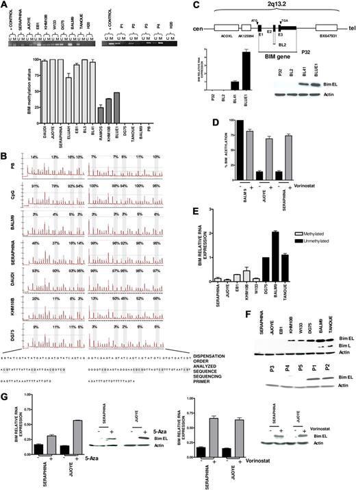 Figure 1. Epigenetic silencing of proapoptotic BIM gene in Burkitt lymphoma. (A) Standard MSP analysis of the BIM gene in BL-derived cell lines and patient samples (P1 and P2, unmethylated BIM; P3 and P4, methylated BIM; top). Quantitative analysis of methylation using quantitative MSP (bottom), including cell lines with complete methylation according to standard MSP analysis (light gray), cell lines with partial methylation (dark gray), and unmethylated tumors (DG75, Tanoue, and BALM9). PB indicates peripheral blood. (B) Pyrosequencing analysis of the BIM promoter area after bisulfite modification showing quantitative methylation profiles of GpG islands (expressed in percentage), which correlate with the data obtained in quantitative MSP. (C) Homozygous deletion of the BIM gene in the EBV- P32 and BL2 cell lines, as revealed by comparative genomic hybridization to BAC microarrays and PCR on tumor genomic DNA, resulting in null expression of BIM as shown by quantitative RT-PCR and Western blot analyses. (D) Quantitative ChIP assay of AcH3 binding to canonical CpG island sequences of BIM promoter in vorinostat-treated and untreated cells. An increase of AcH3 levels after treatment with vorinostat was detected in the hypermethylated Jijoye and Seraphina cell lines, but not in the unmethylated BALM9 cell line. (E) BIM epigenetic silencing was correlated with absent or low expression at RNA levels measured by quantitative RT-PCR, which correlate with BIM epigenetic status. (F) Accordingly, Western blot analysis shows protein down-regulation in BL-derived cell lines and patient samples with hypermethylation of BIM (P1 and P2, unmethylated BIM; P3, P4, and P5, methylated BIM). (G) Treatment with 5-Aza and with vorinostat restored BIM expression in methylated tumors at the RNA and protein levels.