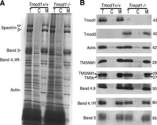 Figure 3. Comparison of cytosol/membrane levels for Tmods and other actin-binding proteins in wild-type or Tmod1-null RBCs. (A) Coomassie blue–stained sodium dodecylsulfate–polyacrylamide gel electrophoresis (SDS-PAGE) of total RBC extracts (T), RBC cytosol (C), and washed membranes (M) prepared by hypotonic lysis of RBCs isolated from wild-type and Tmod1-null mice. (B) Western blots of Tmods, actin, TMs, dematin, 4.1R, and band 3 in total RBC extracts, cytosol, and washed membranes. Tmod1 and Tmod3 are predominantly associated with membranes, and associations of actin, TMs, dematin, and 4.1R with membranes are not altered in the absence of Tmod1. A small amount of the upper TM5NM1 but not the lower TM5b band is detected in RBC cytosol from Tmod1-null mice.