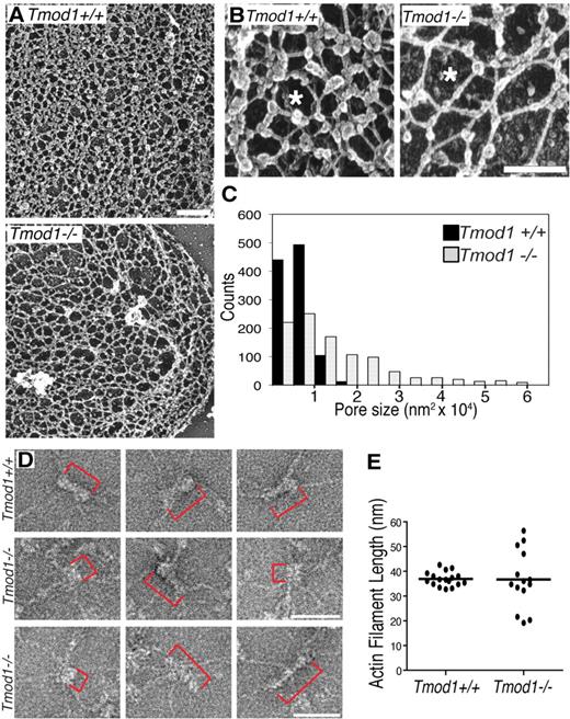 Figure 4. The spectrin-actin lattice displays larger and more variable pore sizes, and actin filament lengths are more variable in the absence of Tmod1. (A-B) Electron micrographs of platinum replicas of unspread RBC membrane skeletons from Tmod1+/+Tg+ mice or Tmod1−/−Tg+ mice. Asterisks indicate pores in the lattice that appear larger in the absence of Tmod1. Bars, (A) 400 nm; (B) 200 nm. (C) Histogram of pore sizes shows 10-fold more size variability and a 2-fold increase in average sizes in the absence of Tmod1; n = 5 skeletons per genotype, with 200 adjacent pores per micrograph. Average pore sizes: 6310 nm2 (± 2820 nm2) for wild-type and 13 352 nm2 (± 12 355 nm2) for Tmod1-null RBCs (P < .001). (D) Electron micrographs of negatively stained junctional complexes in expanded membrane skeletons from wild-type (top) and Tmod1-null mice (middle and bottom). Red brackets indicate actin filaments. Bars, 50 nm. Actin filament lengths are uniform in wild-type junctional complexes but appear shorter or longer in Tmod1-null junctional complexes. (E) Measurements of actin filament lengths in junctional complexes of membrane skeletons from wild-type or Tmod1-null mice. Each dot represents 1 measurement. Average filament lengths: 36.90 nm (± 2.85 nm; n = 17) for wild-type and 36.74 nm (± 11.70 nm; n = 14) for Tmod1-null. Range of filament lengths: 32.80 to 42.64 nm for wild-type and 19.18 to 56.42 nm for Tmod1-null. Differences in average filament lengths between genotypes are not significant, but differences in the range of filament lengths are significant based on an F test for variance (P < .001).