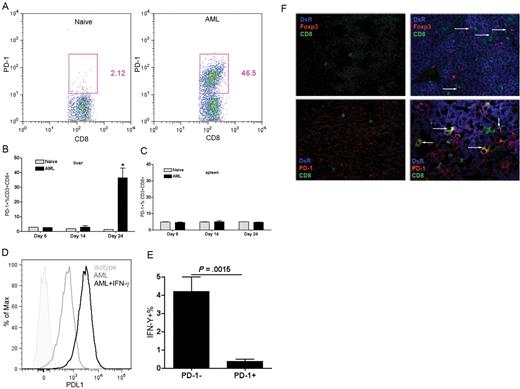 Figure 1. PD-1 expressing CD8+ T cells in the liver of AML-bearing mice displayed impaired function. B6 mice were injected intravenously with 106 C1498FFDsR cells and killed 14, 20, or 25 days after tumor injection. Flow cytometric analysis was performed on liver leukocytes and splenocytes (A-C). (A) Flow dot plot of PD-1 expression on liver CD8+ T cells 25 days after AML injection. (B) PD-1 was up-regulated on liver CD8+ T cells at late phase of AML progression. (C) PD-1 expression was not found on the spleen CD8+ T cells of AML-bearing mice. (D) PD-L1 expression on C1498FFDsR left untreated or treated with IFN-γ for 48 hours was assessed by flow cytometric analysis. PD-L1 expression was found on C1498FFDsR, and mean fluorescent intensity was increased by IFN-γ treatment. (E) Percentage of IFN-γ–producing PD-1+/PD-1− CD8+ T cells was determined by flow cytometry analysis. Percentage of IFN-γ–secreting cells. PD-1+ fraction was much lower than the PD-1− fraction. (F) Liver samples from naive mice (left side) or AML-bearing mice 25 days after C1498FFDsR injection (right side) were evaluated by immunofluorescence staining. Slides were mounted with VECTASHIELD (Vector Laboratories) and images were taken at 40×/1.30 oil objective through Olympus UPlanApo oil lens and an Olympus FV500 camera, compiled with Fluoview software (Version 4.3), then cropped in Adobe Photoshop CS3. (Top panels) Colocalization of tumor cells (DsR+, blue), CD8+ T cells (CD8+, green), and Tregs (Foxp3+, red) is designated by white arrows. (Bottom panels) Colocalization of tumor cells, CD8+ T cells, and PD-1 (red) is designated by white arrows. Results from one of 5 representative experiments are shown. Bar graphs represent mean ± SD.