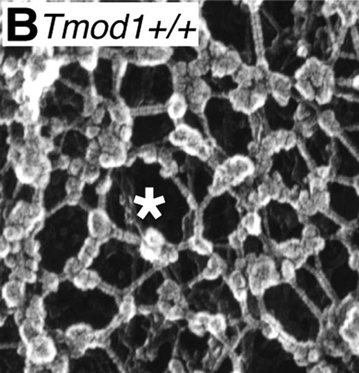 Ordered spectrin-actin–based membrane skeletal network in normal red cells. (Image is Figure 4B from Moyer et al.1)
