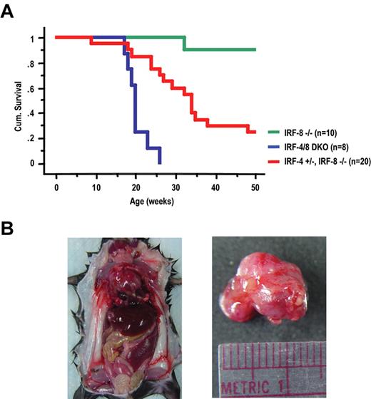 Figure 4. Cumulative survival of IRF-8 KO, IRF-4/8 DKO, and IRF-4+/−IRF-8−/− mice and gross examination of moribund IRF-4/8 DKO mouse. (A) Survival curves were generated by Kaplan-Meier survival analysis. (B) Gross examination of a representative moribund IRF-4/8 DKO mouse showing massive ML, hepatosplenomegaly, and lymphadenopathy.