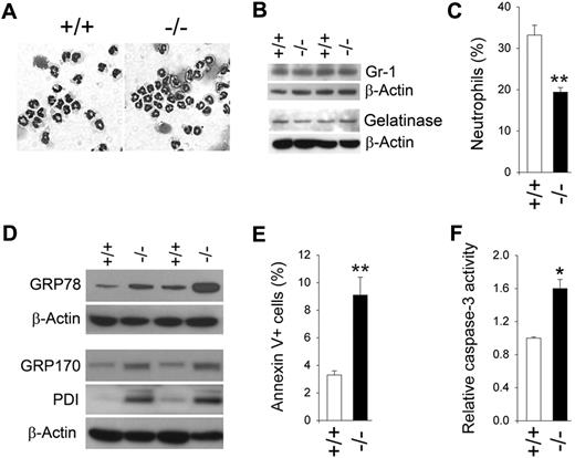 Figure 1. G6pc3−/− BM neutrophils display enhanced ER stress and apoptosis. Bone marrow (BM) neutrophils were isolated from 6- to 8-week-old unaffected (+/+) and G6pc3−/− (−/−) littermates as described in “Isolation of murine bone marrow and human blood neutrophils.” (A) Hema 3–stained cytospins of BM neutrophils. (B) Western blot analysis of protein extracts of neutrophils using antibodies against Gr-1, gelatinase, or β-actin. Data from 2 pairs of littermates are shown and each lane contains 80 μg of protein. (C) A plot of BM neutrophil counts in control and G6pc3−/− mice determined by flow cytometry analysis using anti–Gr-1 and anti-CD11b antibodies (n = 4). (D) Western blot analysis of protein extracts of neutrophils using antibodies against GRP78, GRP170, PDI, or β-actin. Data from 2 pairs of littermates are shown and each lane contains 50 μg of protein. (E) Quantification of apoptotic cells (annexin V+) in BM neutrophils of control and G6pc3−/− mice determined by flow cytometric analysis. At least 5000 cells were used for each determination (n = 4). (F) The DEVD-cleaving activity of active caspase-3 in protein extracts of BM neutrophils. Data represent the mean ± SEM of 3 independent experiments. *P < .05, **P < .005.
