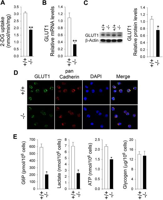 Figure 3. Analysis of 2-DG uptake, the expression of GLUT1, and intracellular G6P, lactate, ATP, and glycogen levels in G6pc3−/− neutrophils. Annexin V–depleted BM neutrophils were isolated from 6- to 8-week-old unaffected (+/+) and G6pc3−/− (−/−) littermates as described in “Depletion of apoptotic cells from neutrophils.” Freshly isolated annexin V–depleted neutrophils were used for 2-DG uptake, quantitative RT-PCR, and Western blot analyses. Immunofluorescence analysis of GLUT1 and measurement of G6P, lactate, ATP, and glycogen were conducted in annexin V–depleted neutrophils that were incubated for 30 minutes at 37°C in glucose-containing RPMI-1640 medium as described in “Immunofluorescene microscopic analyses”; “G6P, lactate, and glycogen determination”; and “Total ATP determination.” For 2-DG uptake and quantitative RT-PCR, the data represent the mean ± SEM of 3 independent experiments. **P < .005. For Western blot and immunofluorescence analysis, at least 3 separate experiments were conducted in which each mouse was assessed individually. (A) Uptake of 2-DG. (B) Quantification of GLUT1 mRNA by real-time RT-PCR. (C) Western blot analysis of protein extracts of annexin V–depleted BM neutrophils using antibodies against GLUT1 or β-actin. Each lane contains 50 μg of protein. The relative GlUT1 protein levels were quantified by densitometry of 4 separate pairs of Western blots. *P < .05. (D) Representative immunofluorescence of GLUT1 staining (green fluorescence), pan Cadherin membrane staining (red fluorescence), and DAPI nuclei staining (blue fluorescence) at 400× magnification. (E) G6P, lactate, ATP, and glycogen levels. Data represent the mean ± SEM of 4 independent experiments. *P < .05.