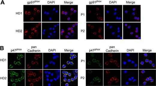 Figure 6. Analysis of the expression of NADPH oxidase in neutrophils of human G6PC3-deficient patients. Annexin V–depleted blood neutrophils were isolated from HD (n = 5; ages 23 to 37 years) and 2 G6PC3-deficient patients, P1 and P2 as described in “Depletion of apoptotic cells from neutrophils.” Two separate experiments were conducted, each analyzed in duplicates. (A) Representative immunofluorescence analysis of gp91phox (red fluorescence) and DAPI nuclei staining (blue fluorescence) at magnifications of 630×. (B) Representative immunofluorescence analysis of p47phox (green fluorescence), pan Cadherin membrane staining (red fluorescence), and DAPI nuclei staining (blue fluorescence) at 630× magnification.