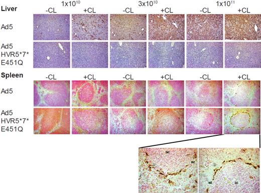 Figure 5. Immunohistochemical analysis of liver and spleen sections. Immunohistochemistry of liver (top panel) and spleen (bottom panel) from macrophage-depleted (CL+) or control mice (CL−) 48 hours after the intravascular administration of 1 × 1010, 3 × 1010, and 1 × 1011 vp of Ad5 or Ad5-HVR5*7*E451Q at low magnification (10×). Liver transduction was only observed for Ad5, while only Ad5-HVR5*7*E451Q efficiently transduced the spleen at high dose in macrophage-depleted mice. High power magnification (40×) of the spleen section at 1 × 1011 vp of Ad5-HVR5*7*E451Q in macrophage-depleted mice is represented below spleen panel. MZ indicates marginal zone; and GC, germinal center.