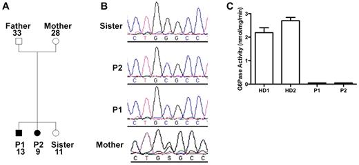 Figure 2. G6PC3 deficiency resulting from homozygous inheritance of G6PC3 mutation G260R in 2 siblings with a multisystem syndrome involving severe congenital neutropenia and recurrent infections. P1 indicates affected brother; and P2, affected sister. (A) Family pedigree. Circles represent female; squares, male; filled symbols, affected; and unfilled symbols, unaffected. Numbers indicate subject ages. (B) DNA sequencing. Chromatograms from family members (father refused). (C) G6PC3 G260R is a complete loss-of-function mutation. G6PC3 activity was measured in lymphoblastoid cell lines from 2 healthy blood donors (HD1 and HD2) and both patients.