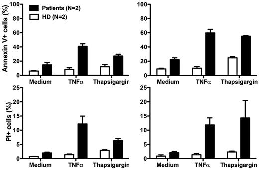 Figure 5. Increased neutrophil apoptosis in patients with G6PC3 deficiency resulting from homozygous inheritance of G6PC3 G260R. Neutrophils from both patients and 2 healthy donors (HD) were cultured at 37°C for 2 hours (left panels) or 4 hours (right panels) in medium alone or medium with the addition of tumor necrosis factor (TNFα) or thapsigargin. Flow cytometry was then performed. Apoptotic cells are defined as annexin V+. Dead cells are defined as propidium iodide–positive (PI)+. Data are from a single experiment performed after the patients were treated for 7 months with G-CSF.