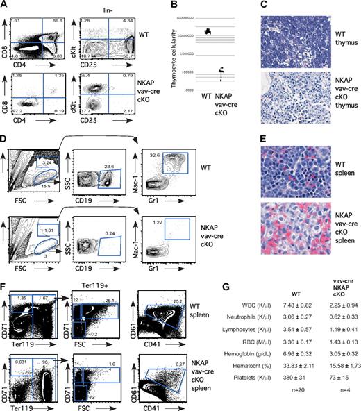 Figure 1. Severe multilineage blocks in hematopoiesis in vav-cre NKAP cKO neonates. (A) Total thymocytes from wild-type (WT) and vav-cre NKAP cKO neonates were examined for surface expression of CD4 and CD8. Lineage-negative thymocytes from WT and vav-cre NKAP cKO neonates were examined for surface expression of c-Kit and CD25. (B) Total thymocyte number in wild-type (n = 13) or vav-cre NKAP cKO (n = 4). Results are shown on a logarithmic plot. A line indicated the average cellularity, and error bars reflect SD. (C) H&E staining of fixed sections of thymus from wild-type or vav-cre NKAP cKO neonates. (D) Neonatal liver was homogenized, and enriched for hematopoietic cells. Hematopoietic cells from WT and vav-cre NKAP cKO neonatal liver were analyzed for presence of B cells (CD19) and granulocytes (Gr-1/Mac1). (E) H&E sections of fixed sections of spleen from wild-type or vav-cre NKAP cKO neonates. (F) Total splenocytes from WT and vav-cre NKAP cKO neonates were analyzed for erythopoiesis by staining with CD71 and Ter119, and for megakaryocyte precursors by staining with CD41 and CD61. (G) CBCs with differential were analyzed on a Hemavet from 4 one-day-old vav-cre NKAP cKO and 20 wild-type littermates. In all of the parameters shown, the difference between WT and vav-cre NKAP cKO pups using the Student t test is significantly significant (P < .001). Data are shown as the average ± SEM.