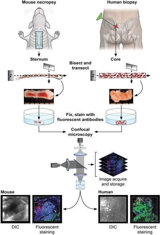 Figure 1. Diagrams of the protocol of BM sample preparation and confocal microscopy. For mouse BM, sternums were bisected sagittally into 2 to 3 segments. For human BM, core biopsies were bisected into segments (2-4 mm). Segments were further transected, fixed (except for EGFP-expressing tissues), and fluorescently stained as whole-mounts. Fluorescently labeled BM tissues were subjected to confocal microscopy, and series of images were used to reconstruct the 3D architecture of BM (related images in supplemental Video 1).
