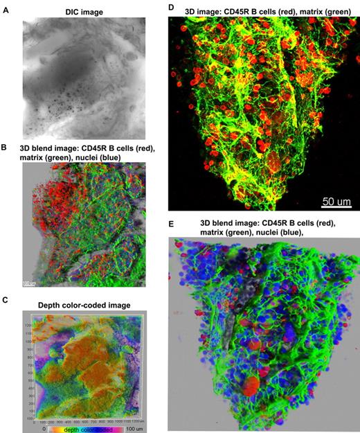 Figure 2. Overview of 3D reconstructions of mouse BM architecture. Using DIC (A), mouse marrow tissue within the bone fossae of the sternum was located and examined; corresponding z-series of immunofluorescence images (B) (approximate volume of 600 × 600 × 150 μm3) were reconstructed. (B) A 3D blend rendering showing large islands of CD45R+ cells (B lymphocytes in red), surrounded by extracellular matrix (perlecan in green), and DAPI (blue) identifying all nucleated cells. (C) A depth color coded 3D image where the depth was pseudocolored (0 μm = orange and 100 = magenta) of the same field as in panels A and B. The close-up 3D images either as maximum intensity (D) or as blend projection (E) display an intricate network of extracellular matrix (perlecan in green) outlining blood vessels and the nests of CD45R+ cells (B lymphocytes in red). DAPI (blue) identifies all nucleated cells (E). Related images appear in supplemental Video 2.