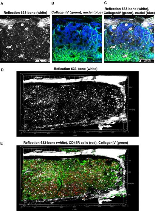 Figure 3. Tiled views of confocal reflection and fluorescence of the normal mouse BM. Confocal reflection 3D image (A) displays the bone structure (white): the outer shell as well as several internal bone spikes and trabecullae can be identified (using a 633-nm laser light reflected on the imaging detector). In the corresponding confocal fluorescence 3D image (B), cells (DAPI, blue) and vascular structures and extracellular matrix (collagen type IV, green) are shown; several tissue discontinuities appear like “holes.” The merged image (C) clearly demonstrates the overlap of the bone structures over these discontinuities. Tiled z-stacks of images were collected over large volume (2.6 × 1.2 mm × 150 μm) of the mouse BM tissue and computationally stitched. A large tile over entire bone fossae is depicted in panels (D) (bone reflection) and E (merged with the fluorescence of CD34 in red, collagen type IV in green, DAPI in blue) respectively, to illustrate very good tissue preservation. Related images appear in supplemental Video 3).