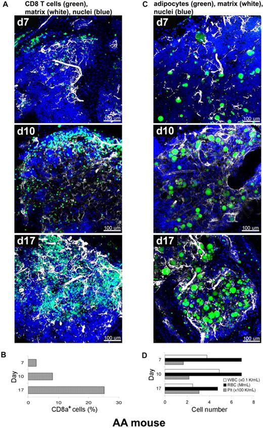 Figure 5. Altered BM tissue of AA mouse model. AA mice were generated by infusion of B6-LN cells into sublethally irradiated C.B10 mice. BM whole-mount specimens of recipients were fluorescently stained using antibodies to CD8+ T cells (green), perlecan (white), and DAPI (nuclei) without or with BODIPY 493/503 (adipocytes), and subjected to examination on days 7, 10, and 17 by confocal microscopy (A,C). (A) After initial hypocellularity (day 7), a massive radial expansion of CD8+ T cells (green) was observed at day 10 and day 17 in parallel with extracellular matrix remodeling (white). Quantitative analysis of CD8+ cells in the BM samples was performed by flow cytometry (B). Concomitant staining of adipocytes (BODIPY in green), (C) revealed increasing number of adipocytes over time in parallel with extracellular matrix remodeling (white). (D) The cell numbers of WBCs, RBCs, and platelets in peripheral blood on days 7, 10, and 17 were enumerated by an automated cell counter. Scale bars are in micrometers. Related images appear in supplemental Video 6.