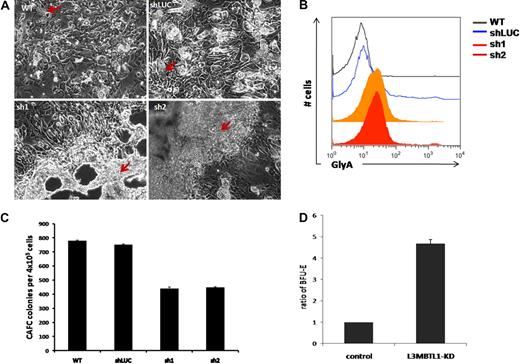 Figure 4. L3MBTL1-KD leads to expansion of erythroid progenitors in long-term culture. (A) Sorted 4 × 105 GFP+ CD34+ were plated on MS5 stromal cell layer and cultured for 5 weeks. At week 5, the colonies were examined using an inverted optical microscope. The red arrows indicate the cobblestone area forming cells in the wt and shLUC figures. The red arrows indicate the overgrowth of progenitor cells (predominantly erythroid) in the sh1 and sh2 photographs. (B) The expression of GlyA on floating cells from 5-week LTC-IC cultures was evaluated by flow cytometry. (C) CAFC colony numbers were evaluated at week 5 of MS-5 stromal cell–based culture (n = 2). (D) Week 5 LTC-IC cells were plated on methylcellulose, and the secondary BFU-E colonies were scored after 10 days. The ratio of BFU-E colonies is shown, based on BFU-E numbers in the control cells.