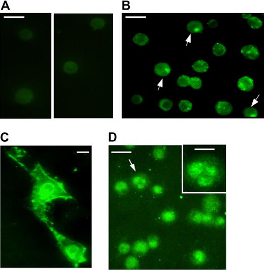 Figure 4. Subcellular localization of transduced TAT-NF-Ya in different types of (A-B) Human peripheral blood cells, (C) NIH 3T3 cells, (D) K562 cells. Cells treated with TAT-NF-Ya were incubated with anti-GST AlexaFluor 488 conjugate. (A) Antibody-stained control cells that were not transduced; 2 areas of a single slide are shown. (B,D) Arrows indicate examples of nuclear staining. (D) Inset: Magnified image of the cell denoted by the arrow. (A-B,D) Bar represents 20 μm. (C,D inset) Bar represents 10 μm. Procedures for protein delivery and visualization are described in “TAT-NF-Ya protein delivery to the cells.”