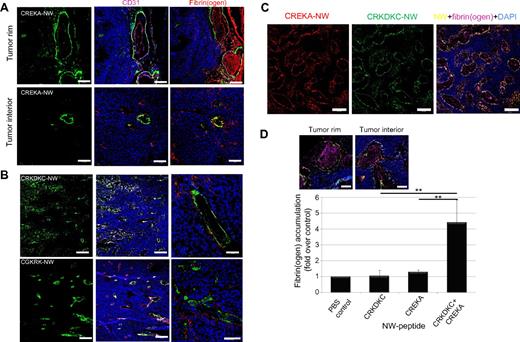 Figure 1. Combining CREKA-NWs with nanoworms coated with another tumor-homing peptide enhances homing efficiency. (A) Iron oxide nanoworms coated with FAM-labeled CREKA peptide were injected intravenously (5 mg of iron per kilogram of body weight) into nude mice bearing orthotropic 22Rv1 human prostate tumors. The mice had been preinjected with Ni-liposomes to reduce uptake by the reticuloendothelial system.22 Tumors were harvested 5 hours later, and tumor sections were stained with antibodies and examined by confocal microscopy (the 5-hour time point was found to be optimal for nanoworm homing with regard to accumulation of the nanoworms in the tumor and clearance of nanoworms from the blood). The CREKA-coated particles are green; blood vessels and clotting were visualized separately with anti-CD31 (magenta) or antifibrin(ogen) staining (red); nuclei were stained with DAPI (blue). Bars represent 200 μm. (B) Nanoworms coated with FAM-labeled CRKDKC or CGKRK were injected intravenously, and the tissues were collected and processed as in panel A. CRKDKC- or CGKRK-coated particles are green; blood vessels visualized with anti-CD31 are magenta (white indicates colocalization of magenta and green) and those visualized with anti-fibrin(ogen) staining are red (yellow indicates colocalization of red and green); nuclei were stained with DAPI (blue). Large vessels were selected for the panels on the right because intravascular clotting (which is not promoted by CRKDKC-NWs or CGKRK-NWs) is most apparent in larger vessels. Bars represent 200 μm (left and middle panels) and 100 μm (right panels). (C) A mixture of nanoworms coated with rhodamine-labeled CREKA (red) and FAM-labeled CRKDKC (green) was injected intravenously (2.5 mg of iron per kilogram of each nanoworm preparation), and the tissues were collected and processed as in A and stained for fibrin(ogen) (magenta); nuclei were stained with DAPI (blue). Bars represent 200 μm. (D) Mice were injected with the indicated materials as in panels A, B, or C. The sections stained with anti-fibrin(ogen) antibody were subjected to image analysis with Scanscope to quantify fibrin(ogen)-positive areas. The insets show examples of anti-fibrin(ogen) immunostaining in the tumor rim (left) and interior (right) from mice injected with the nanoworm mixture. Bars represent 50 μm. Statistical analyses were performed with analysis of variance. Error bars represent SEM (n = 5-6); **P < .01.