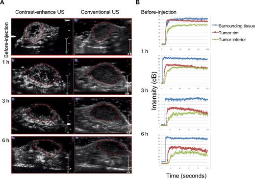 Figure 2. CEUS imaging of blood circulation in tumors of mice treated with peptide-coated nanoworms. (A) Mice preinjected with Ni-liposomes were subsequently injected with a mixture of CREKA-NWs and CRKDKC-NWs and, after the indicated periods of time, injected with an ultrasound contrast agent. CEUS and conventional ultrasound (US) images obtained at the different time points are shown. The images are representative of 3 tumors imaged. (B) Enhancement-analysis curves of blood flow in different tumor regions and the surrounding tissue from experiments described in panel A. The orientation of the tumors is slightly different between the time points because the mice were anesthetized for each scan and reintroduced to the ultrasound instrument; n = 3.