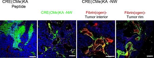 Figure 4. CRE(CMe)KA-NW homing to 22Rv1 tumors. Mice bearing orthotropic 22Rv1 xenograft tumors were injected intravenously with 200 μg of FAM-labeled CRE(CMe)KA or 5 mg of iron per kilogram of nanoworms coated with FAM-CRE(CMe)KA. The peptide was allowed to circulate for 3 hours, and nanoworms were allowed to circulate for 5 hours. The mice were then perfused through the heart with PBS, and the tumors were collected. Tumor sections were stained with CD31 or anti-fibrin(ogen) (red) and examined by confocal microscopy. Nanoworms are green; nuclei were stained with DAPI (blue). Bars represent 200 μm. n = 3.