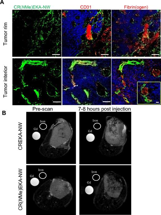 Figure 5. Improved tumor homing of nanoworms coated with an N-methylated CREKA peptide analog. Nanoworms coated with FAM-labeled CREKA peptide or its N-methylated variant, CR(NMe)EKA, were injected intravenously into mice bearing 22Rv1 tumors (total dose 5 mg of iron per 1 kg). (A) Tumors were harvested 5 hours later, and tumor sections were stained with antibodies and examined by confocal microscopy. CR(NMe)EKA-NWs are green; blood vessels and clotting were visualized separately with anti-CD31 or anti-fibrin(ogen) staining (red). Nuclei were stained with DAPI (blue). Bars represent 100 μm (50 μm in the inset). (B) T2-weighted magnetic resonance images (fast spin echo, repetition time = 6.4 seconds, echo time = 69 ms). CREKA-NWs or CR(NMe)EKA-NWs were injected intravenously into tumor-bearing mice. The particles were allowed to circulate for 7-8 hours (the time determined in preliminary experiments to be optimal for differential homing). Gray-scale images of axial planes through the tumors are shown. Gadolinium (Gd) and Feridex (iron) were used as reference standards. n = 3-4.