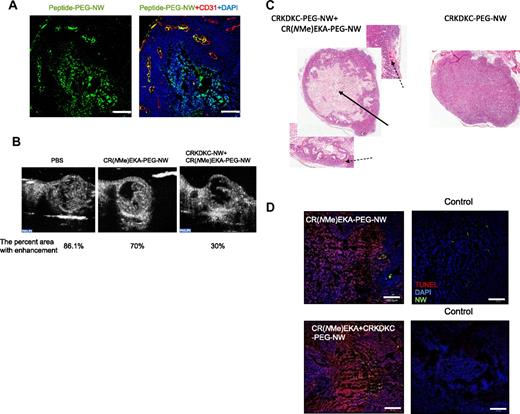 Figure 6. Nanoworm distribution and effects on intravascular clotting, tumor apoptosis, and tumor therapy. Mice bearing 2-week-old orthotopic xenografts of 22Rv1 human prostate cancer were injected intravenously with nanoworms coated with peptides through a 5-kDa PEG spacer. The nanoworms were administered every other day for 14 days (5 mg of iron per kilogram per day, total cumulative dose 35 mg/kg). (A) Tumor sections were stained with anti-CD31 (red); CR(NMe)EKA-NW/CRKDKC-NW combination is shown as green; nuclei were stained with DAPI (blue). Bars represent 200 μm. The necrotic area at the center of the tumor is autofluorescent. (B) CEUS imaging and analysis showed reduction in tumor blood flow at the end of treatment. The images are representative of n = 3. (C) Staining with hematoxylin and eosin showed a large necrotic area (arrow) in the middle of a typical tumor treated with the CR(NMe)EKA-NW/CRKDKC-NW combination and occluded vessels in the viable rim of these tumors (broken arrows). A tumor of a similar size from a mouse treated with CRKDKC-NWs alone is shown for comparison. (D) Apoptosis analysis by TUNEL staining is shown as red; nanoworm combination is shown as green; nuclei were stained with DAPI. Bars represent 200 μm.