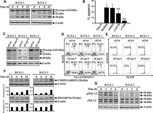Figure 1. Involvement of ER stress-associated signaling in spontaneous B-CLL cell apoptosis. (A,F,G) Time-course analysis of caspase-4 proteolytic processing, CHOP/GADD153 and BiP/GRP78 expression, and JNK1/2 phosphorylation during spontaneous B-CLL cell apoptosis. Western blot analysis was performed in whole-cell lysates (25 μg for caspase-4, BiP/GRP78, and JNK1/2, and 40 μg for CHOP/GADD153) extracted from freshly isolated B-CLL cells and B-CLL cells cultured in complete medium for the indicated times (n = 12). Protein loading was assessed by reprobing the blots with an anti–β-actin mAb. In caspase-4 blots, separated panels are shown because long X-ray film exposure was necessary to detect the 20-kDa subunit. The asterisk in caspase-4 blots indicates bands derived from unknown cleavage. The density of the bands corresponding to CHOP/GADD153 and BiP/GRP78 was evaluated by densitometric analysis. Densitometry units (U) were calculated relative to β-actin. The data shown for patients 1 and 2 are representative of 12 patients. (B) Effect of pharmacologic caspase-4 inhibition on spontaneous B-CLL cell apoptosis. Apoptosis was evaluated by flow cytometric analysis of hypodiploid nuclei in B-CLL cells cultured for 24 hours in complete medium with or without 50μM of the caspase-4 inhibitor z-LEVD-fmk, 50μM of the pan-caspase inhibitor z-VAD-fmk, or 0.005% DMSO as control (n = 7). Results are presented as the mean ± SD of all 7 patients examined. **P < .01 (each caspase inhibitor vs DMSO) according to Student t test. (C-E) Effect of caspase-4 down-regulation on spontaneous B-CLL cell apoptosis. Freshly isolated B-CLL cells were transfected with 0.5μM control nontargeting (siCtrl) or caspase-4 siRNA (siCasp-4) as described in “siRNA nucleofection” and then cultured in complete medium for 72 hours (n = 7). Caspase-4 expression (C) was analyzed by Western blot as described in panel A. Apoptosis was evaluated by flow cytometric analysis of annexin V/PI-stained cells (D) and hypodiploid nuclei (E). (D) Results are presented as the percentage of viable (annexin V−/PI−), early apoptotic (annexin V+/PI−), late apoptotic (annexin V+/PI+), and necrotic cells (annexin V−/PI+). (E) Percentage of hypodiploid nuclei. (C-E) Results shown for patients 1, 2, and 3 are representative of 7 patients.