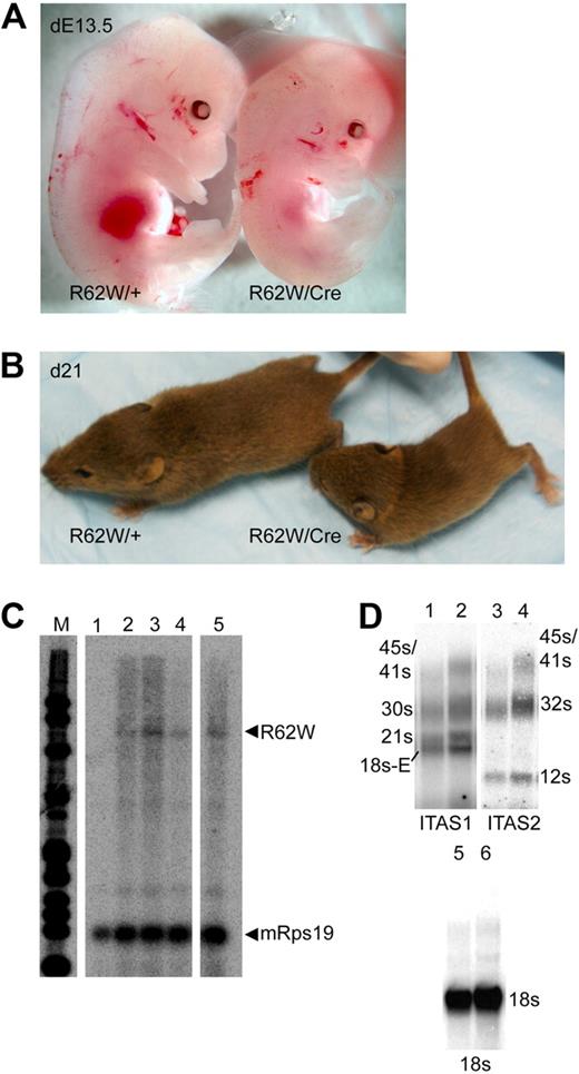 Figure 2. Analysis of transgenic mice carrying the conditional RPS19R62W construct with (R62W/Cre) and without (R62W/+) the Prion-Cre transgene. (A) Day 13.5 embryos. (B) Three-week-old pups. (C) RNase protection analysis of fetal liver RNA from day 13.5 embryos. Lane 1 indicates RNA from R62W/+ embryo; and lanes 2 to 5, RNA from R62W/Cre embryos. The transgenic RPS19 mRNA protects a 584-bp fragment of the probe. The mouse Rps19 mRNA protects 2 93-bp fragments of the probe, providing an internal control. (D) Northern blot analysis of rRNA processing. The individual rRNA products are indicated at the side of the figure. Lanes 1 and 2 indicate bone marrow RNA from R62W/+ (lane 1) R62W/Cre (lane 2) animals probed with an ITS1 probe; lanes 3 and 4, bone marrow RNA from R62W/+ (lane 3) R62W/Cre (lane 4) animals probed with an ITS2 probe; lanes 5 and 6, bone marrow RNA from R62W/+ (lane 5) R62W/Cre (lane 6) animals probed with an 18s rRNA probe. The apparent increases in the level of 21s (ITS1) and 12s (ITS2) are the result of the increased amount of R62W/Cre RNA in lanes 2, 4, and 6 as demonstrated by the level of 18s hybridization.
