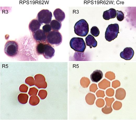 Figure 5. Morphologic analysis of Wright-Giemsa-stained Lin− bone marrow cells from R62W transgenic mice in the basophilic erythroblast (R3) and reticulocyte (R5) gates. The analysis was performed on a Nikon Eclipse TE300 microscope with a 40×/0.75 NA oil objective under Cargill Immersion oil (type 5). Images were taken with a Nikon N70 camera. No subsequent manipulations were performed. (Left) Analysis of cells from mice carrying the RPS19R62W transgene alone (RPS19R62W). (Right) Analysis of cells from mice carrying the RPS19R62W transgene and the Prion-Cre transgene (RPS19R62W; Cre). Note the binucleate cells among the RPS19R62W, Cre basophilic erythroblasts (R3), and the poorly hemoglobinized and nucleated cells among the RPS19R62W, Cre reticulocytes (R5).