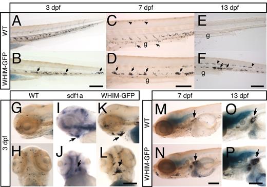 Figure 3. Neutrophil development in WHIM-GFP larvae. (A-F) Sudan Black staining in the CHT of wild-type (WT) (A,C,E) or WHIM-GFP (B,D,F) larvae at 3 (A,B), 7 (C,D), and 13 (E,F) dpf. Lateral view, anterior to the left. Arrows point to neutrophils over the gut (C) or in clumps in the CHT (B,D,F). Arrowheads point to neutrophils along the dorsal ridge (C) or midline (F). (G-L) Lateral view (G,I,K) or ventral view (H,J,L) of the head of WT (G-J) or WHIM-GFP (K,L) 3-dpf larvae stained with Sudan Black (G,H,K,L) or for SDF1a expression (I,J) by WISH. Arrows point to area of dark SDF1a expression (I,J) or areas of neutrophil accumulation (K,L) on the ventral side of the head under the jaw. (M-P) Sudan Black staining to show neutrophils in the kidney (arrows) in 7 (M-N) and 13 (O-P) dpf WT (M,O) or WHIM-GFP (N,P) larvae. Lateral view, g indicates gut. Bar = 200 μm (A-P).