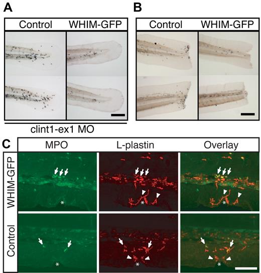 Figure 6. WHIM-GFP neutrophils fail to respond to tail transections or chronic inflammatory signals. (A) Sudan Black staining of tails from Control (left) or WHIM-GFP (right) larvae injected with clint-ex1 MO to induce epidermal hyperproliferation and chronic inflammation in the tail. (B) Sudan Black staining of tail transections in Control (left) or WHIM-GFP (right) larvae. (C) Confocal imaging at wounds in WHIM-GFP (top) or Control (bottom) larvae at 3 dpf immunolabeled with a rabbit antibody to MPO and a fluorescein isothiocyanate–conjugated anti–rabbit Fab fragment (left) followed by a rhodamine-red–conjugated rabbit antibody to L-plastin (middle). Overlapping signals are yellow in the overlay (right). Arrows are MPO+, L-plastin+ neutrophils; arrowheads are MPO−, L-plastin+ macrophages; white * indicates location of the wound. Control = GFP− siblings of WHIM-GFP larvae. Representative images of ≥ 20 larvae in each condition. Bars = 200 μm (A-B); 100 μm (C).