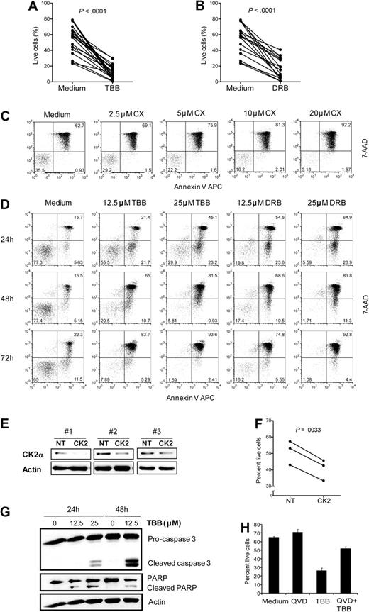 Figure 2. CK2 inhibition induces apoptosis of CLL cells. Primary CLL cells were cultured for 48 hours in medium alone or with (A) 25μM TBB (n = 22) or (B) 25μM DRB (n = 17) and cell viability was evaluated after 48 hours. (C) CLL cells were incubated with the indicated doses of CX-4945 and viability was assessed at 48 hours. Results are representative of 5 patients analyzed. (D) CLL cells were incubated without or with TBB (12.5μM, 25μM) or DRB (12.5μM, 25μM) and viability was assessed at 24, 48, and 72 hours. Results are representative of 11 patients analyzed. (C-D) The percentage of live (bottom left), early apoptotic (bottom right), and late apoptotic/necrotic (top right) cells is indicated in the respective quadrants. (E-F) MEC1 cells were nucleofected with control (NT) or CK2α siRNA (CK2) and cultured for 72 hours. A total of 3 independent experiments are shown. (E) Cell lysates were immunoblotted with antibodies against CK2α or actin. (F) Viability of MEC1 nucleofected with control vs CK2α siRNA was analyzed at 72 hours. Results for each independent experiment are shown. (G) CLL cells were cultured with TBB (12.5μM, 25μM) for 24 and 48 hours. Cell lysates were immunoblotted with antibodies against caspase 3, PARP, or actin, as loading control. Results are representative of 3 patients analyzed. (H) CLL cells were preincubated with 20μM QVD-OPH for 1 hour and then cultured with 12.5μM TBB for 48 hours. Results are shown as mean ± SEM of triplicates and are representative of 3 patients analyzed. Cell viability was assessed by annexin V/7-AAD staining. Results are representative of 3 patients analyzed. (A-H) All evaluations of cell viability were performed by flow cytometric analysis after annexin V/7-AAD staining.