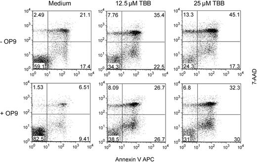 Figure 4. CK2 inhibition overcomes the protective effect of OP9 stromal cells. Purified CLL cells were cultured alone (−OP9) or cocultured with OP9 stromal cells (+OP9), and treated or not with the indicated doses of TBB. Viability was assessed after 48 hours by annexin V/7-AAD staining and flow cytometric analysis. Results are representative of 4 patients analyzed. Numbers represent the percentage of cells in each quadrant.